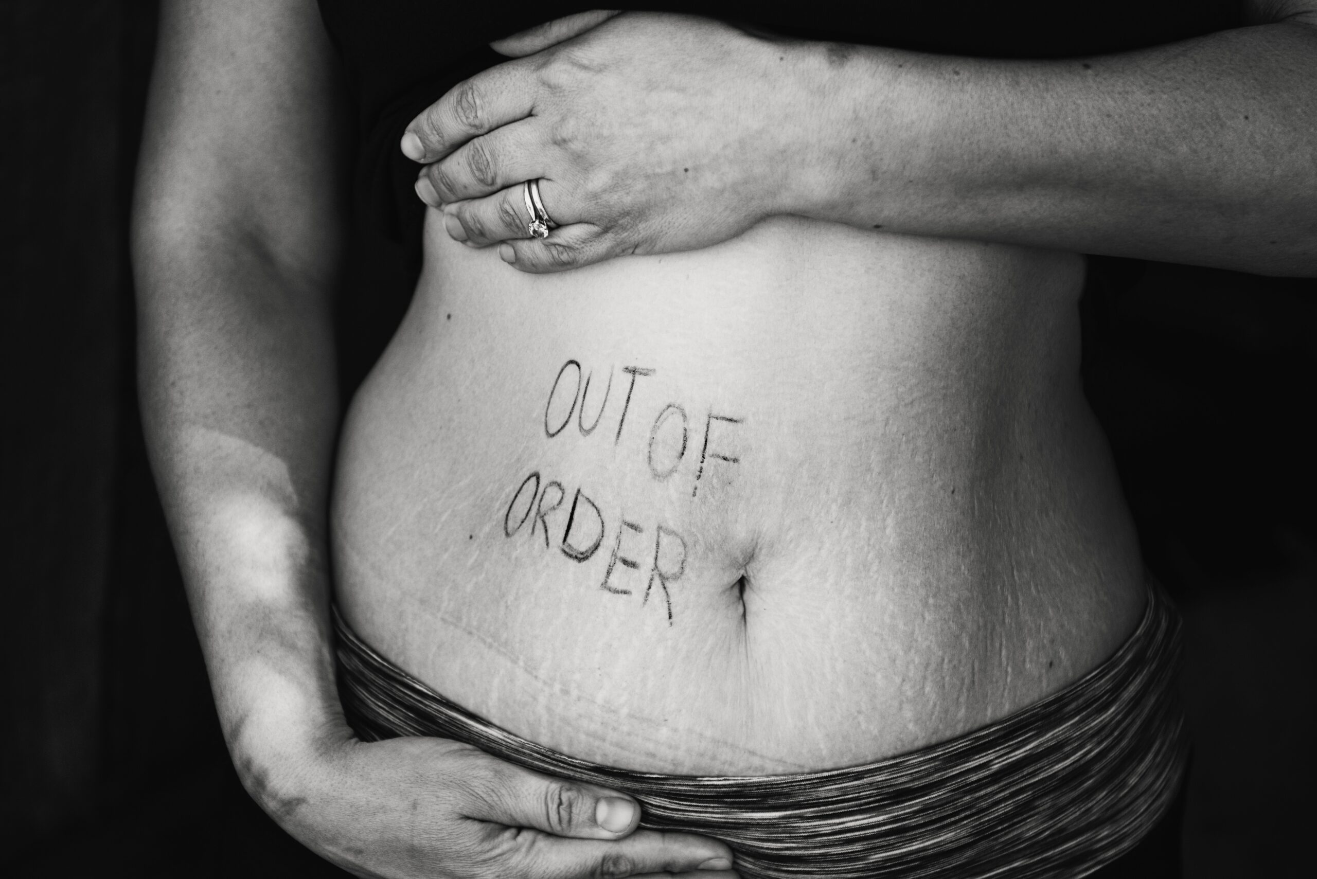 How to Improve Gut Health